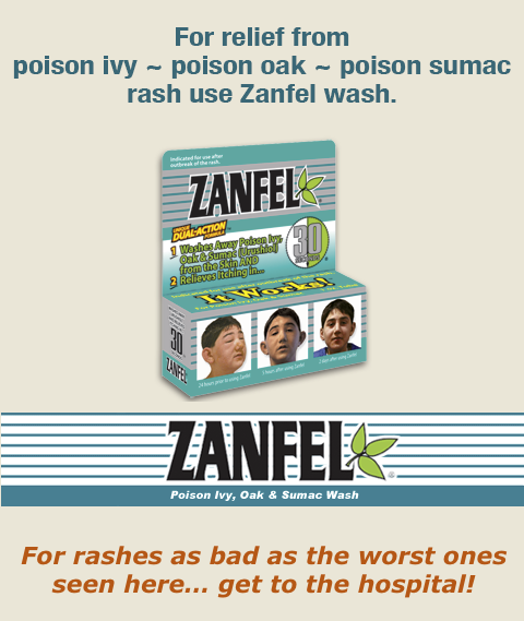 Zanfel poison ivy wash